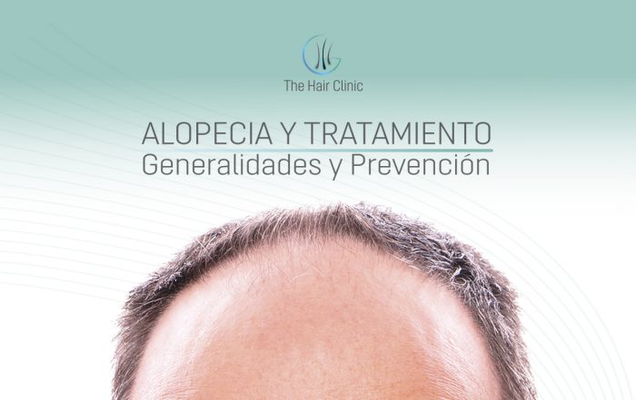 Alopecia y Tratamiento