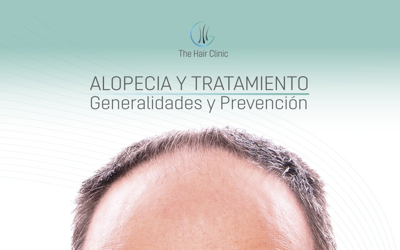 Alopecia y Tratamiento