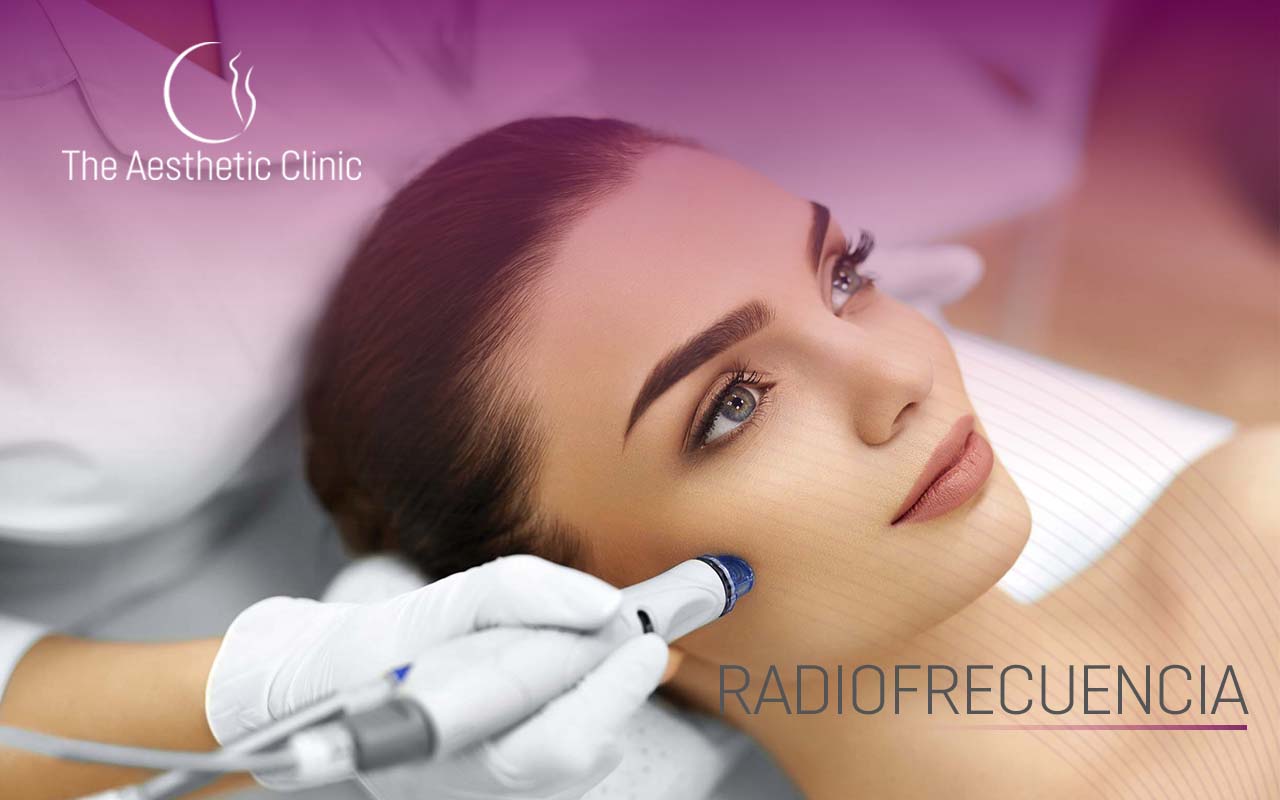 What is Radiofrequency